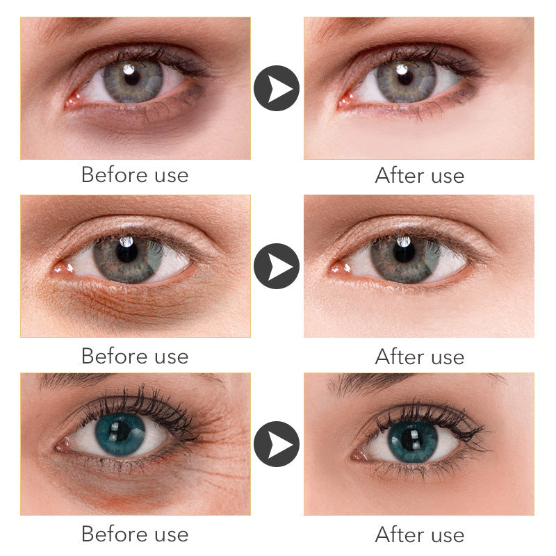 Beauty Eye Cream30mlwish Women's Skin Care Products - Chilazexpress Ltd