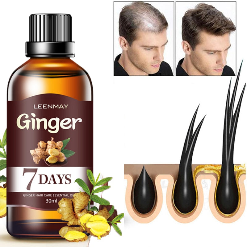 Ginger Serum Treatment for Fast Hair Growth, Soften Scalp and Repair Damaged Hair Essence 7 Days