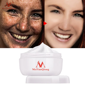 Melanin Dark Spots Removal And Face Lift Firming Face Skin Care Beauty